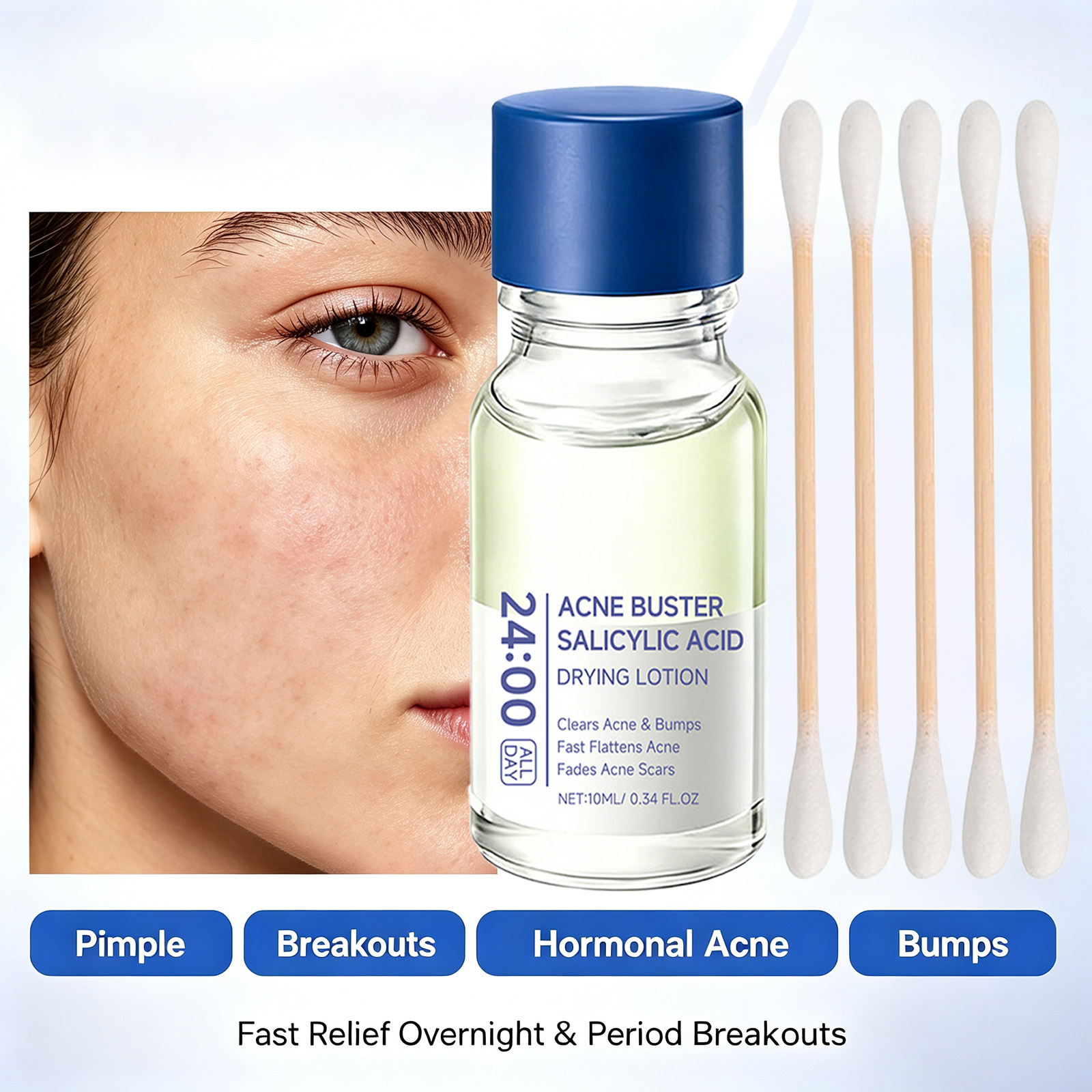 Tranexamic Acid Serum - 살리실산 여드름 치료 세럼, 나이아신아마이드 함유,