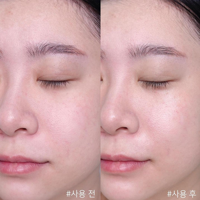 센텔라 아시아티카 타임 리버스 크림 어드밴스드 속효성  - Centella Asiatica Toner 리뷰 및 가격