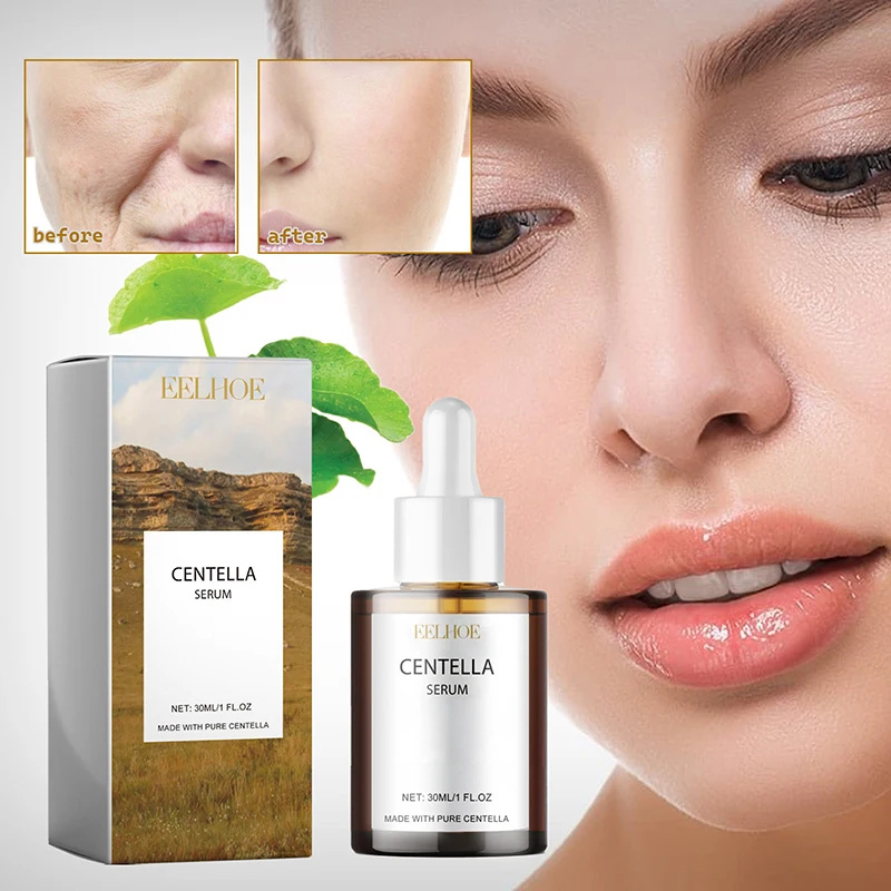 센텔라 아시아티카 페이스 세럼 건성 피부 영양 공급,  - Centella Asiatica Toner 리뷰 및 가격