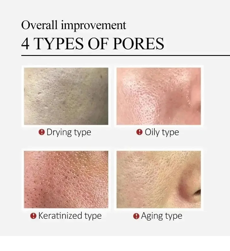 센텔라 아시아티카 모공 축소 페이스 세럼, 얼굴 붉은기 - Centella Asiatica Toner 리뷰 및 가격