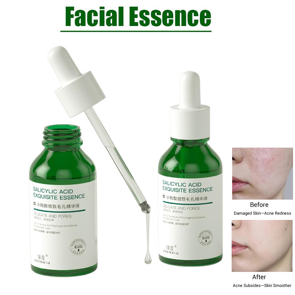 1pc 살리실산 델리케이트 포어 페이셜 에센스 각질 제 - Tranexamic Acid Serum 리뷰 및 가격